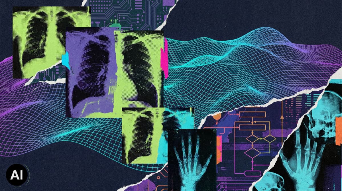 AI Tools for Breast Cancer Detection Fall Short of Radiologists' Expectations