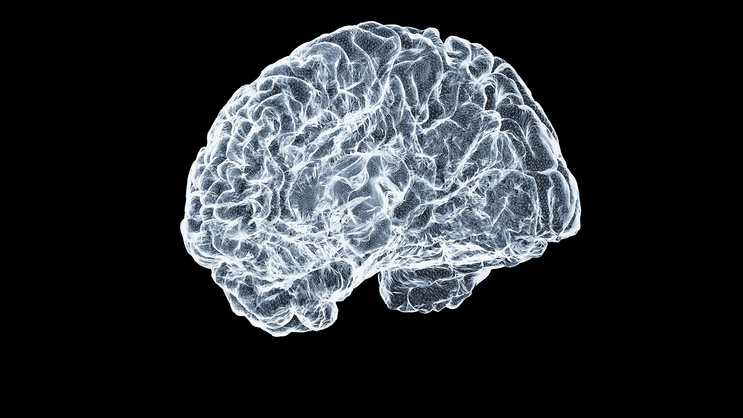NVIDIA and C-BRAIN Use AI to Accelerate Alzheimer’s Research