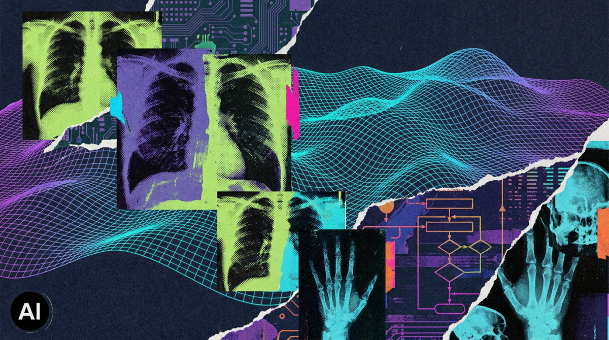 AI Tools for Breast Cancer Detection Fall Short of Radiologists' Expectations