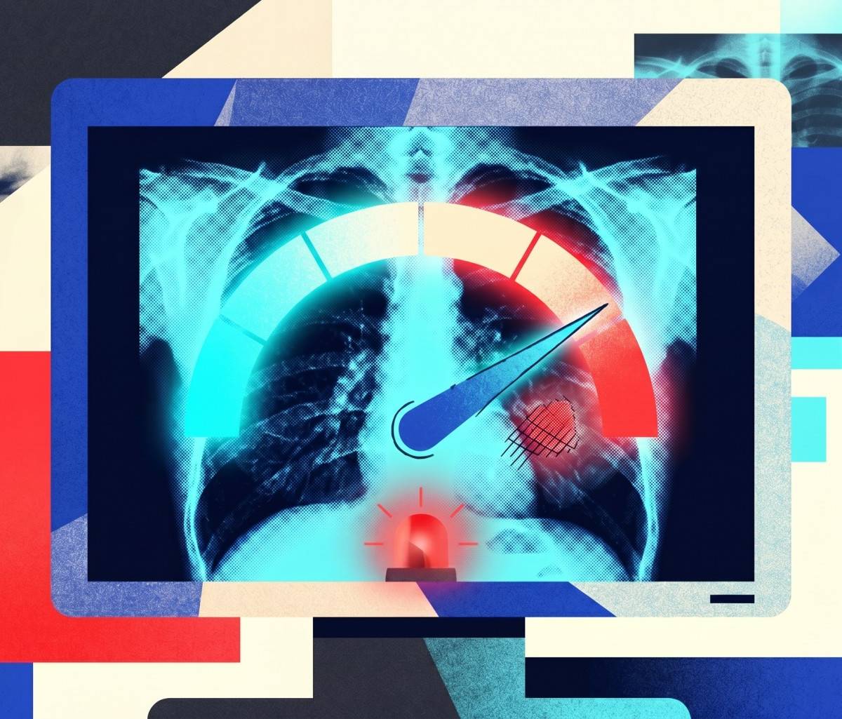 RadLE 2.0 Tests AI Chatbots' Confidence in Reading X-Rays